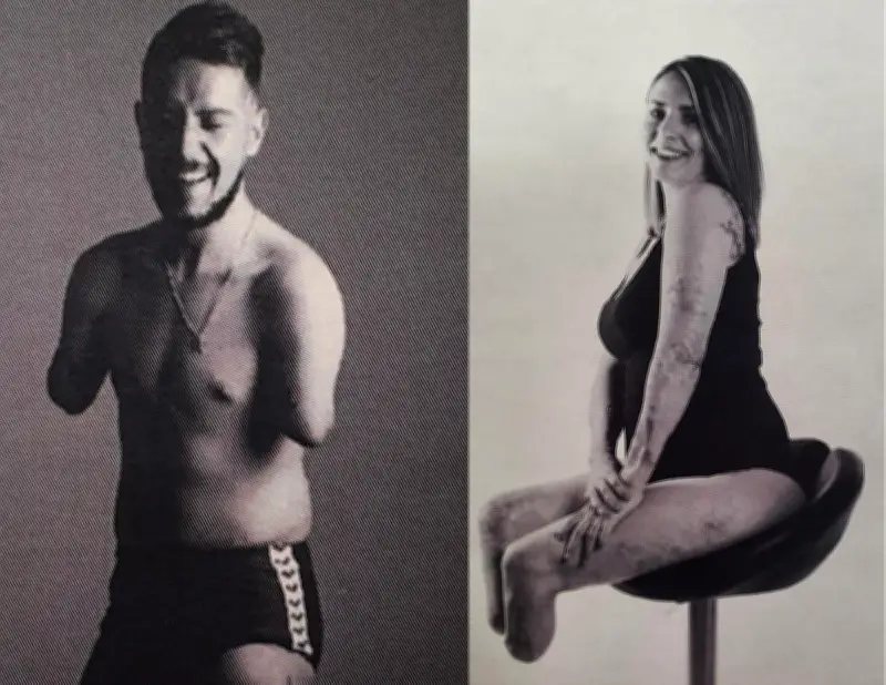 Exposition « Different is beautiful » : une centaine de portraits pour changer le regard sur le handicap