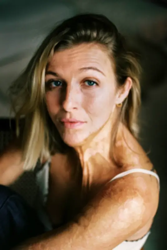 Julie Bourges, l'activiste qui tire son épingle du feu environnemental