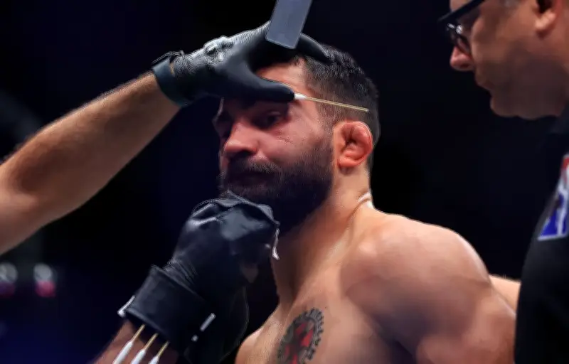 La dangereuse mode des oreilles en chou-fleur volontaires sur TikTok