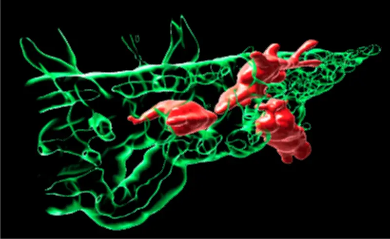 Le paradoxe mécanique des métastases : comment les cellules cancéreuses adaptent leur viscosité
