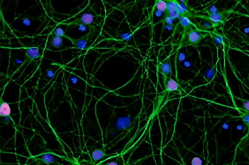 SLA : entre 5 000 et 7 000 Français touchés, décès de l'acteur Eric Dane à 53 ans