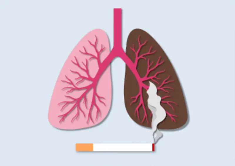 Tabac et cancer du poumon : pourquoi certains fumeurs échappent à la maladie ?