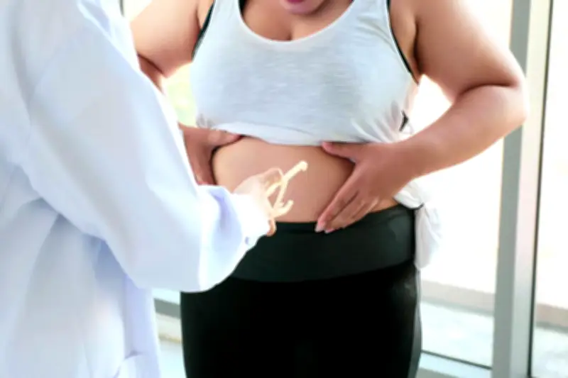 Gastroplastie endoscopique : une solution méconnue contre l'obésité sans chirurgie