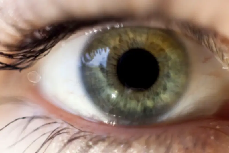 Myodésopsies : quand les mouches volantes deviennent une urgence ophtalmologique