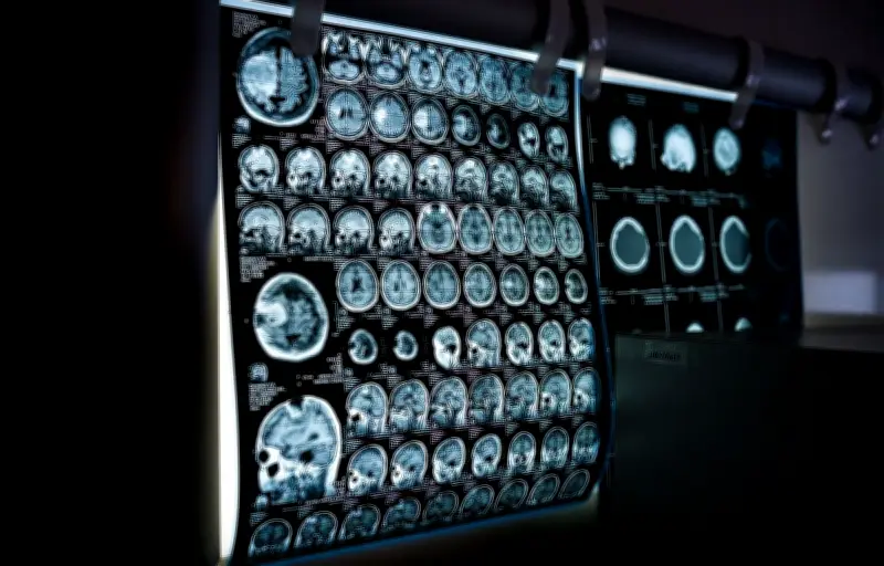 Épidémie de méningite dans le Kent : deux morts et onze hospitalisations