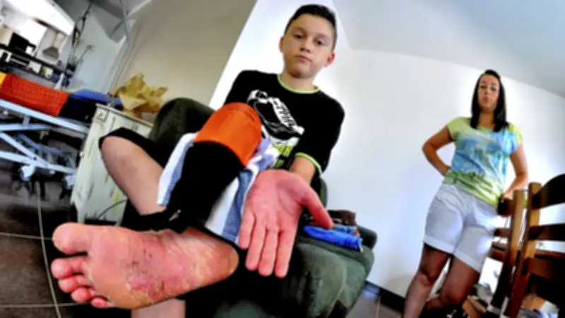 Protège-tibias Decathlon suspectés d'allergie grave chez un jeune footballeur gardois