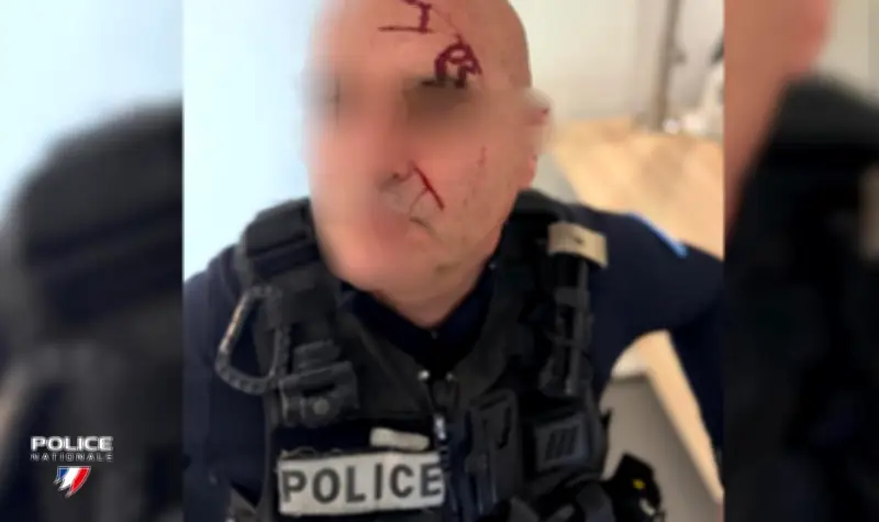 Un an de prison pour un homme ayant brisé les lunettes d'un policier à Saint-Paul-lès-Dax