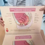 Endométriose : la Nouvelle-Aquitaine en pointe pour le diagnostic et la prise en charge