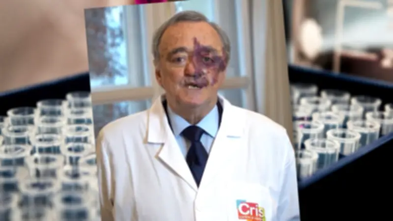 Cancer du pancréas : une découverte majeure occultée par des moqueries sur une tache