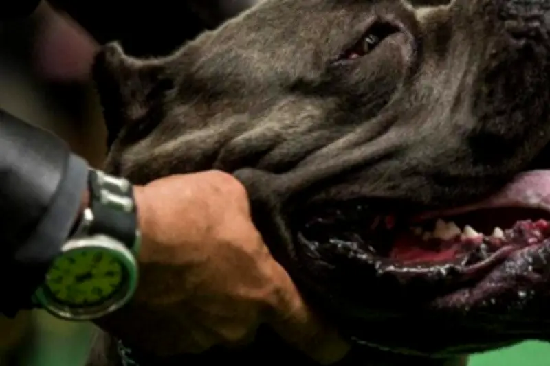 Oise : un enfant mordu cinq fois par des chiens, son pronostic vital écarté