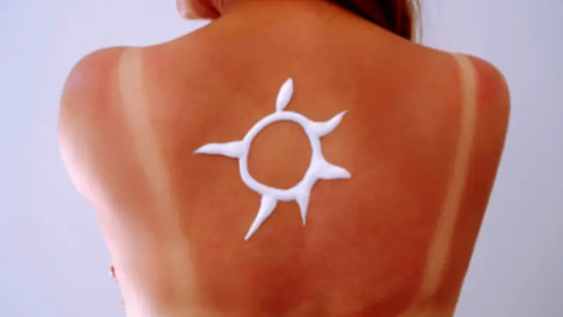 Sun-tattoo : une mode dangereuse qui inquiète les dermatologues