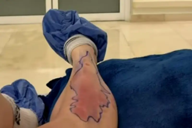 Taylor Momsen, star de Gossip Girl, hospitalisée après une morsure d'araignée au Mexique