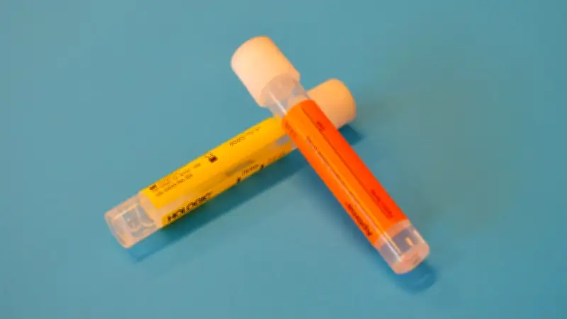 Un nonagénaire meurt aux toilettes d'un hôpital à Barcelone
