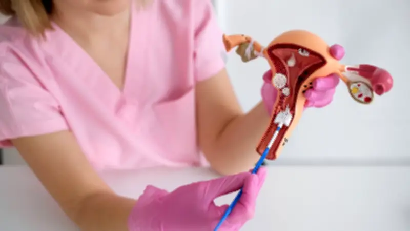 Vente du dispositif de stérilisation FemBloc suspendue en France