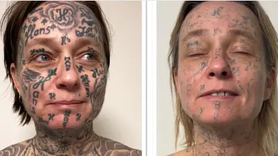 Pays-Bas : une femme forcée à 250 tatouages par son ex-compagnon lance une campagne de détatouage