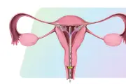 France suspend la vente de FemBloc, dispositif de stérilisation féminine