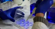 La découverte génétique improbable qui unit deux maladies neurodégénératives