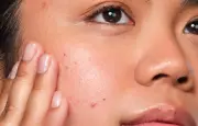 Sérum acide salicylique The Ordinary : le soin anti-acné à 5 euros
