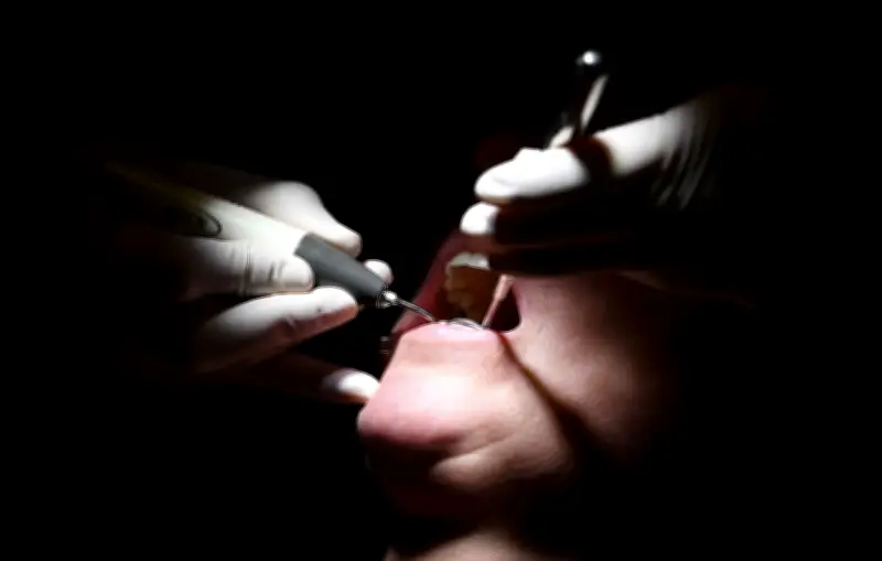 Ancien dentiste jugé pour avoir mutilé des patients en Lozère