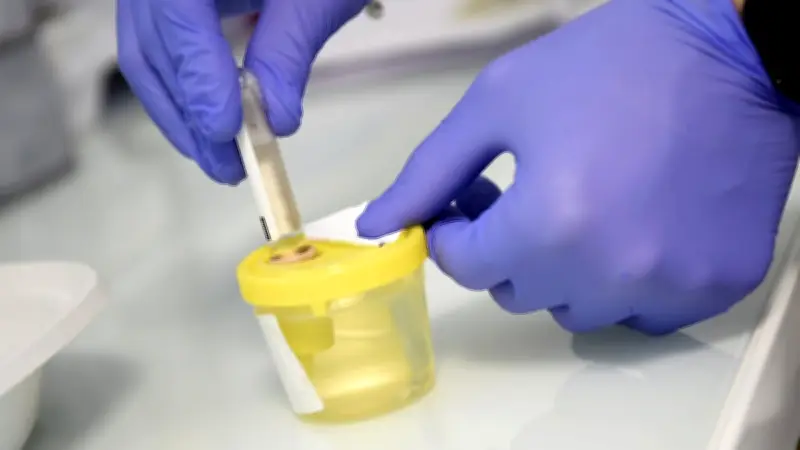 Cadmium : alerte du Dr Souvet sur un toxique "jamais vu"