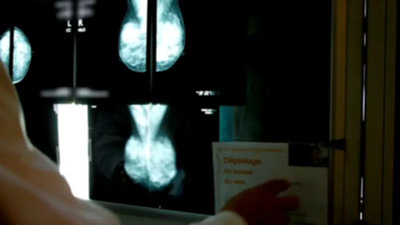 Cancer du sein : une pétition pour l'application de la loi