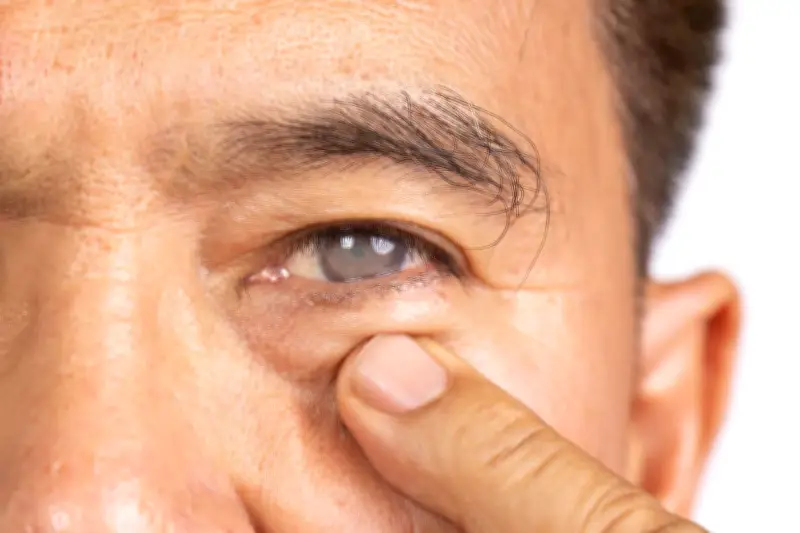 Cataracte : déroulement de la chirurgie la plus pratiquée en France