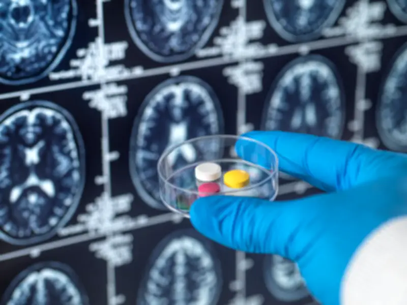Déremboursement Alzheimer : accélération du déclin cognitif selon une étude