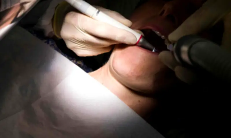 Ex-dentiste jugé à Mende pour mutilations et escroquerie sur des patients