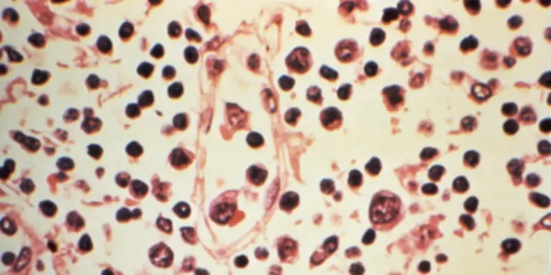 Hantavirus : lexique pour comprendre la souche Andes et son taux de létalité