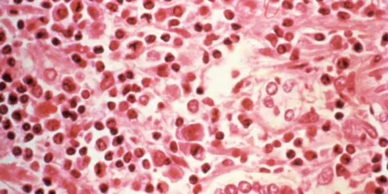 Hantavirus : origine, transmission, symptômes, ce qu'il faut savoir