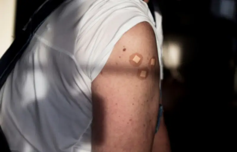 Pénurie de dermatologues : dépistage cutané, le parcours du combattant