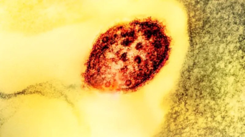 Pourquoi la rougeole fait-elle son retour en France malgré le vaccin ?