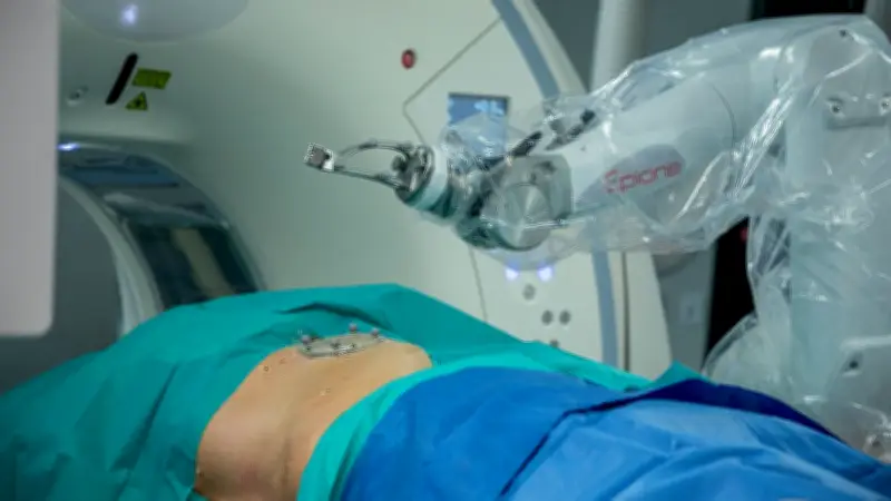 Robot Epione au CHU de Nîmes : révolution contre le cancer du foie
