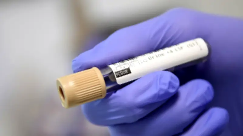 Test cadmium : 8,99 µg/g, un taux alarmant qui interroge