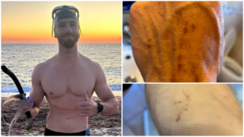 Un Sétois attaqué par un requin pointe noire en Sardaigne