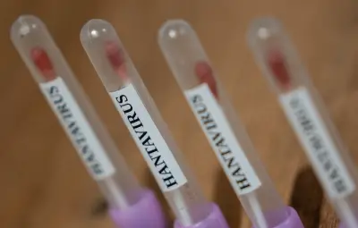 OMS : risque de propagation d'Hantavirus « absolument faible »