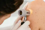 Dermatologie : des généralistes équipés pour réduire l'attente de six à huit mois