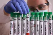Hantavirus des Andes : 20 à 40% de mortalité, un virus méconnu