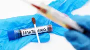 Hantavirus : la France impose une quarantaine renforcée à l'hôpital pour tous les cas contacts