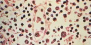 Hantavirus : lexique pour comprendre la souche Andes et son taux de létalité