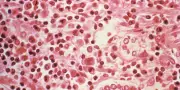 Hantavirus : origine, transmission, symptômes, ce qu'il faut savoir
