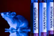 Hantavirus : recherche intensive faute de remède et vaccin