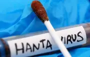 Hantavirus : un Américain testé positif, un Français symptomatique