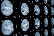 Étude espagnole sur le cancer du pancréas retirée après conflit d'intérêts