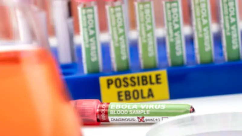 Ebola en France : patient isolé, cas contacts identifiés, faible risque