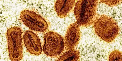 Deux virologues inculpés aux États-Unis pour importation illégale de monkeypox