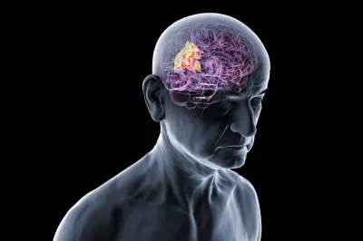 Disqualifier la vision romantique des maladies neurodégénératives