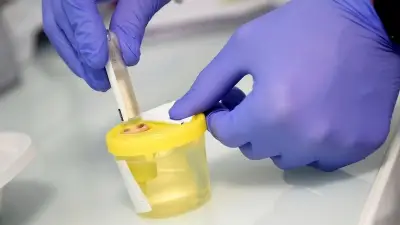 Dépistage du cadmium remboursé à 60% dès le 16 juin