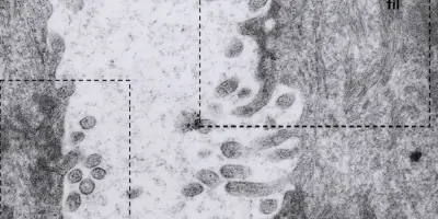 Histoire du mystérieux hantavirus des Andes
