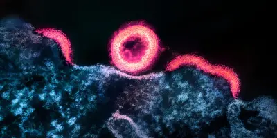 VIH : découverte de nouvelles cellules réservoirs où le virus se cache
